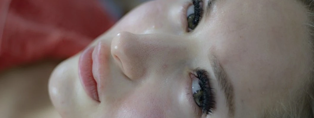 Kako poskrbeti za nečisto, mastno kožo in akne