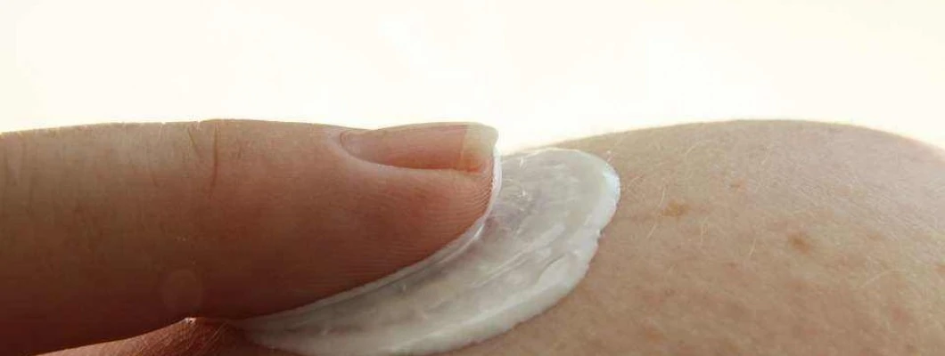 Kako si lahko pomagate, če imate suho kožo