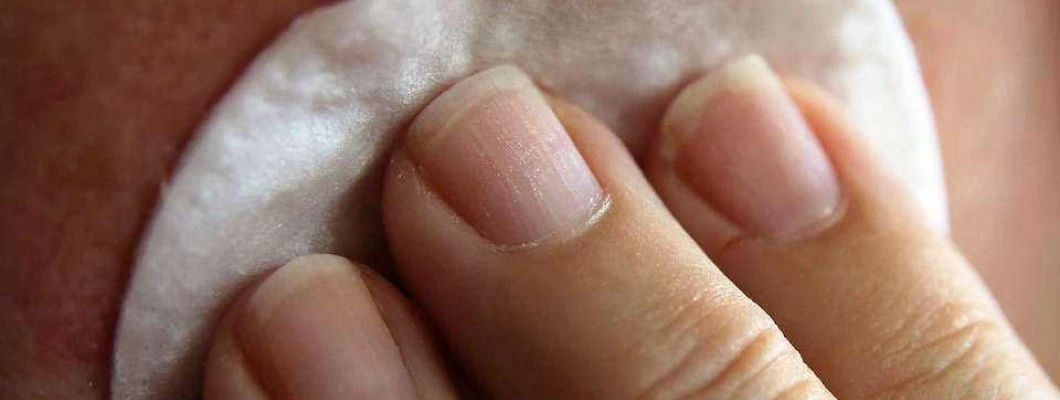 Kako na hitro določite tip vaše kože