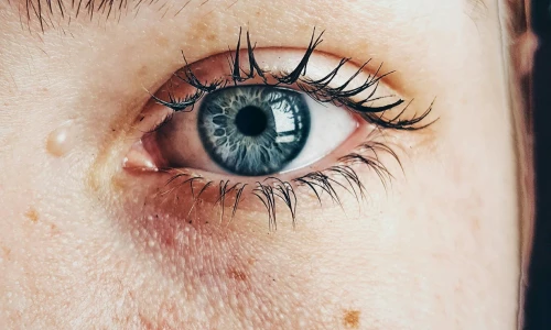 Prve gube: Zakaj nastanejo, kako poteka staranje kože in kako ga lahko upočasnimo